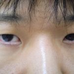 平行型二重を作りたい！　（画像あり）