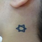 刺青を消したい　首特集１　（画像あり）