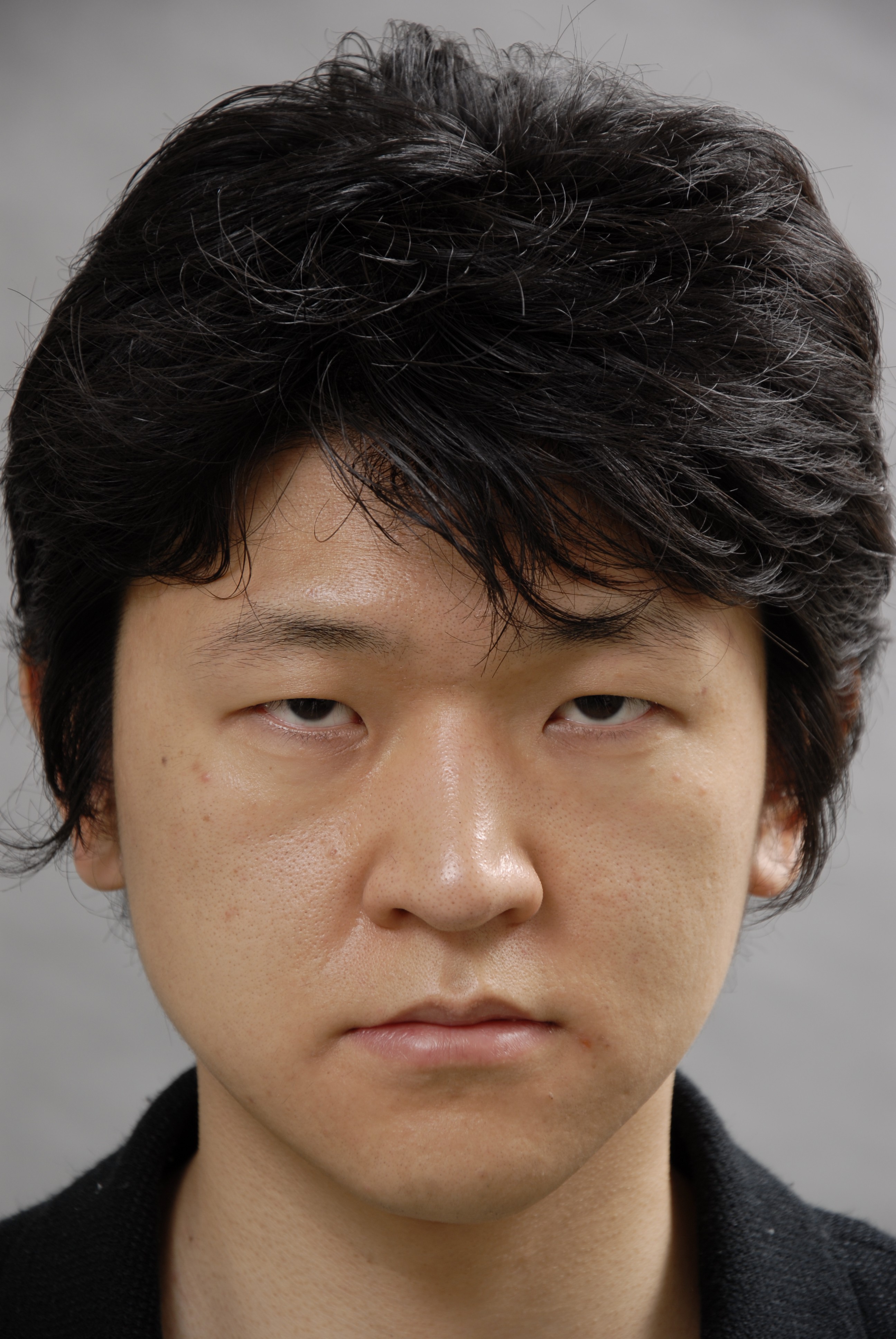 男性に多い美容外科施術 1 画像あり 横浜で働く美容外科院長の美容整形ここだけの話ブログ 男性に多い美容外科施術 1 画像あり 横浜で働く美容外科院長の美容整形ここだけの話ブログ