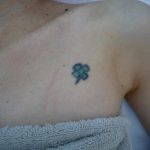 刺青を消したい　ワンポイントの刺青　２　（画像あり）
