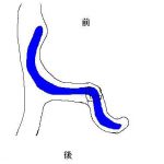 耳の美容外科施術　（画像あり）