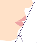 アゴの美容外科施術　（画像あり）