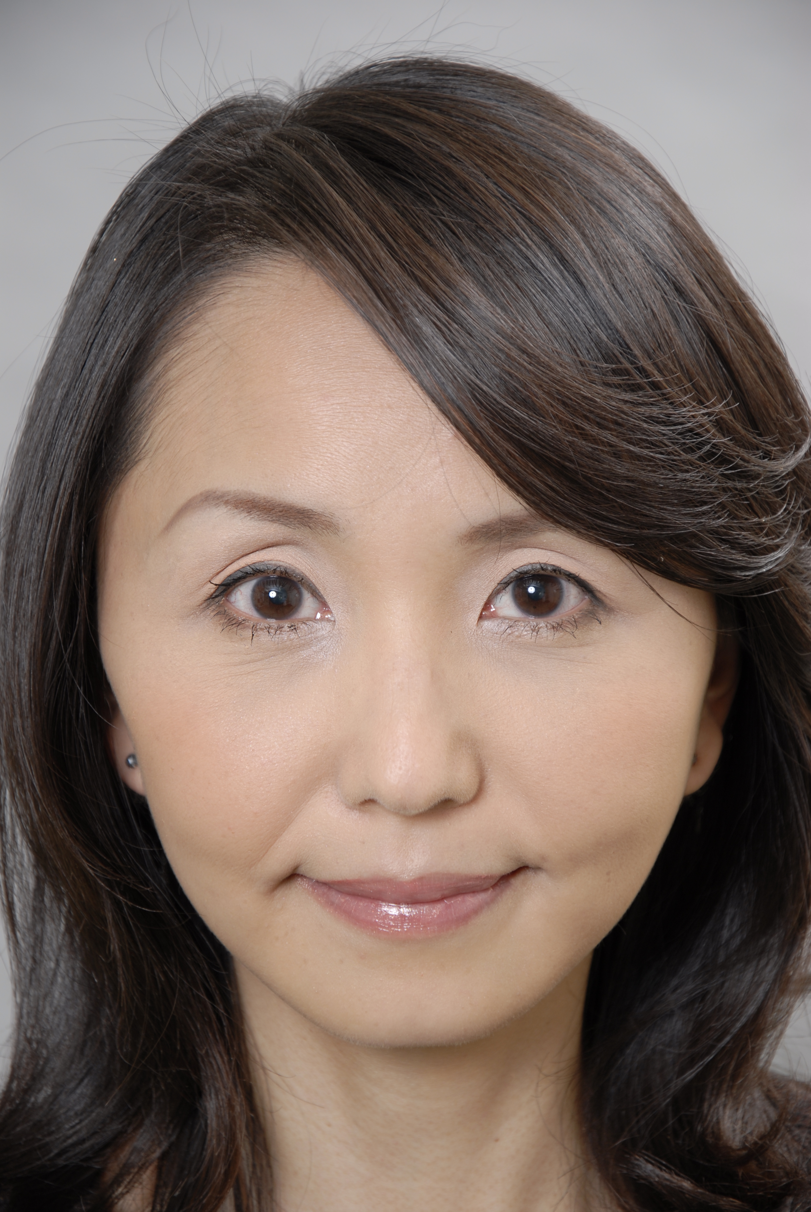 フェイスリフトで失敗しないために 画像あり 横浜で働く美容外科院長の美容整形ここだけの話ブログ フェイスリフトで失敗しないために 画像あり 横浜で働く美容外科院長の美容整形ここだけの話ブログ