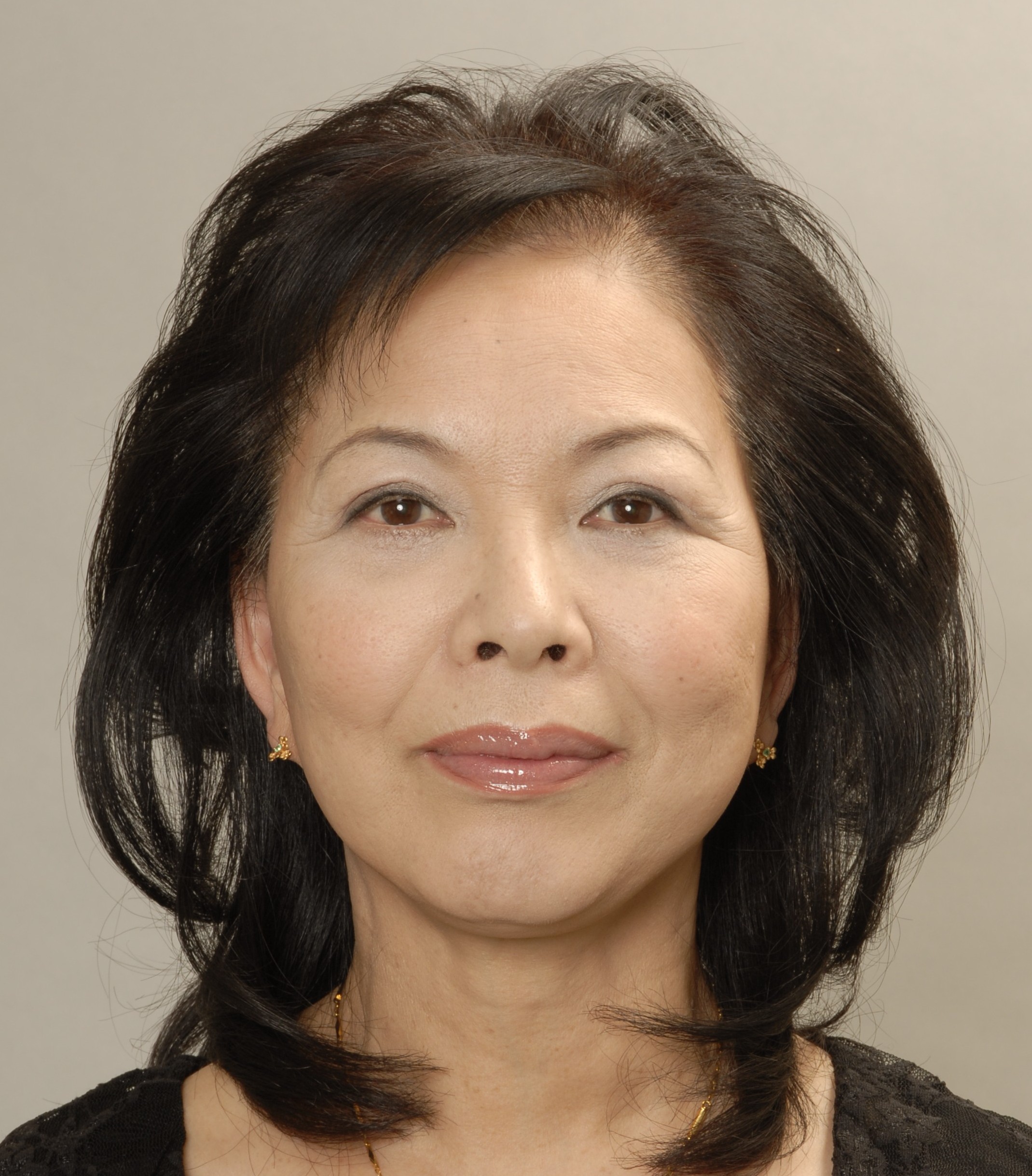 フェイスリフト 頬の脂肪吸引 画像あり 横浜で働く美容外科院長の美容整形ここだけの話ブログ フェイスリフト 頬の脂肪吸引 画像あり 横浜で働く美容外科院長の美容整形ここだけの話ブログ