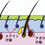 ワキガ治療と多汗症治療の違い