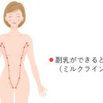 副乳のお話し