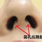 人中短縮術の噂話１，（ほんとかうそか）（画像あり）