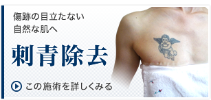 刺青除去
