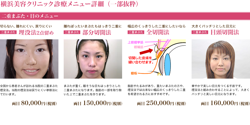 二重まぶた・目のメニュー