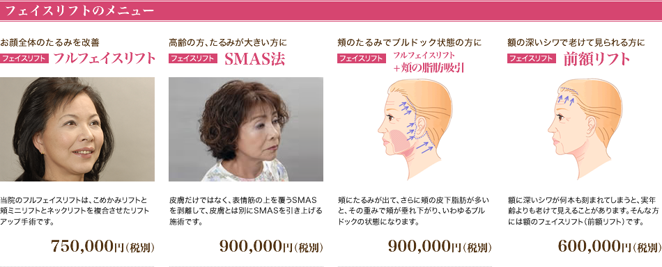 フェイスリフトのメニュー