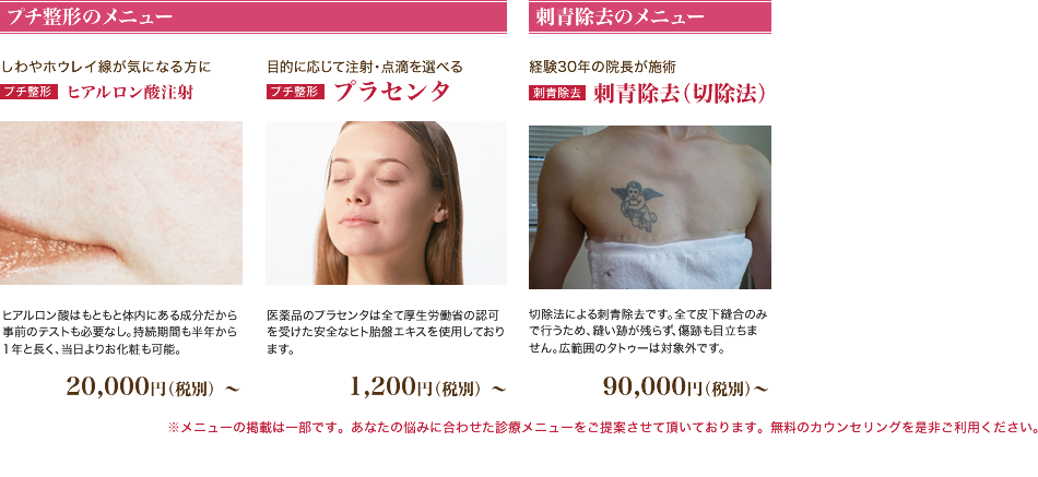 若返り・プチ整形のメニュー、刺青除去のメニュー