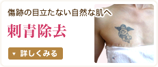 刺青除去