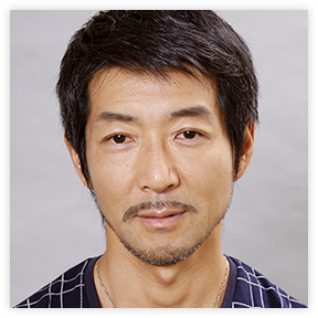 目の美容外科　症例3