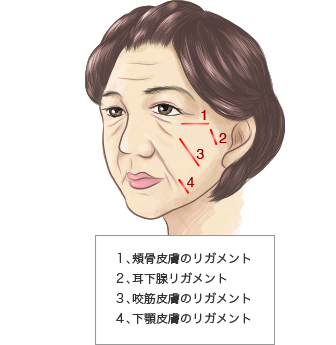 リガメント処理について