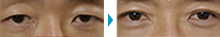目の部分モニター症例写真