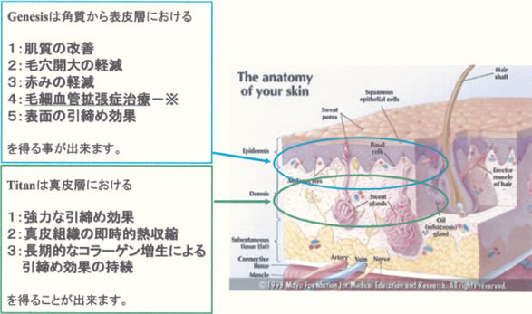 ジェネシス（肌質・毛穴改善）とタイタン（たるみ改善）の効果