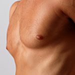 男性の乳頭（乳首）縮小 施術例