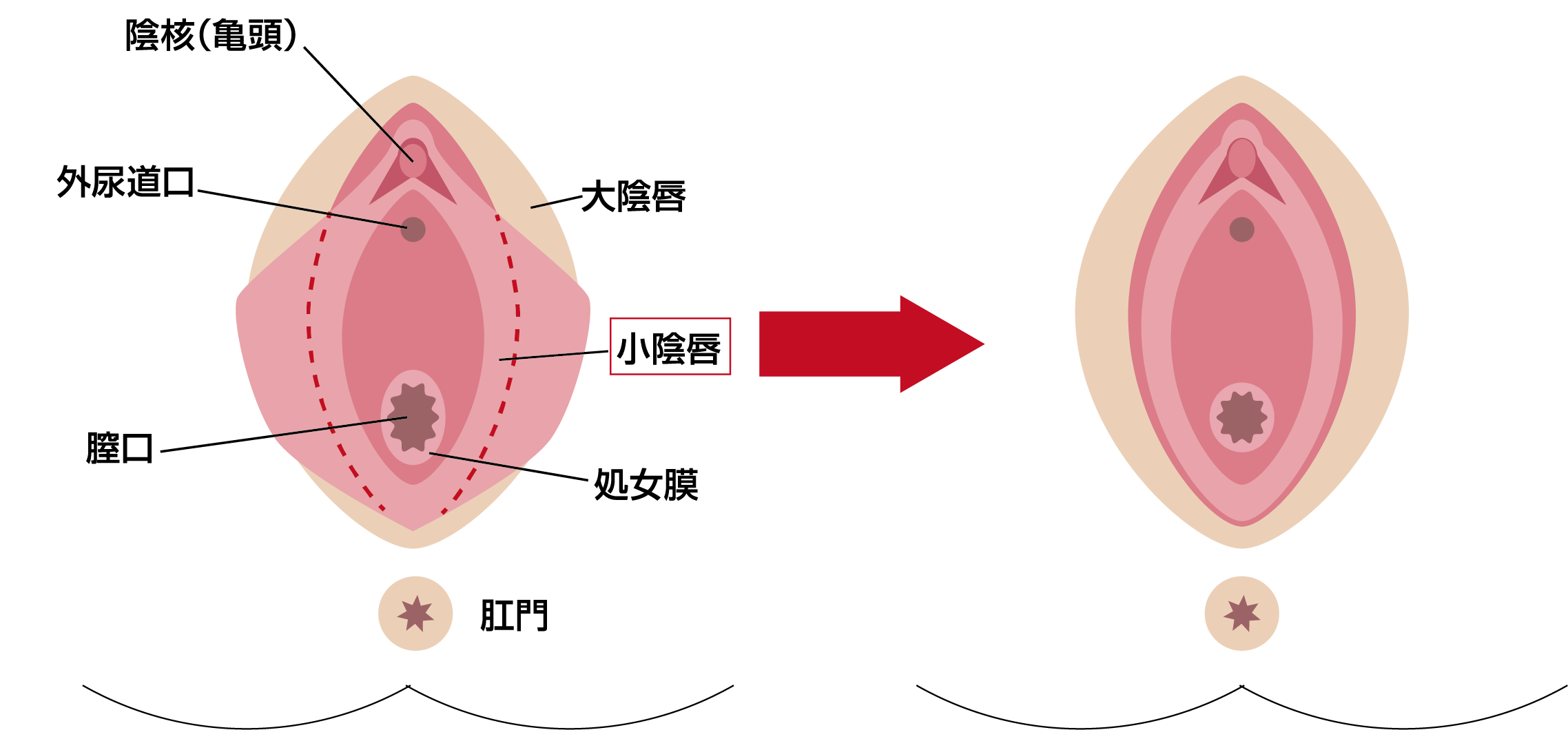 婦人科形成