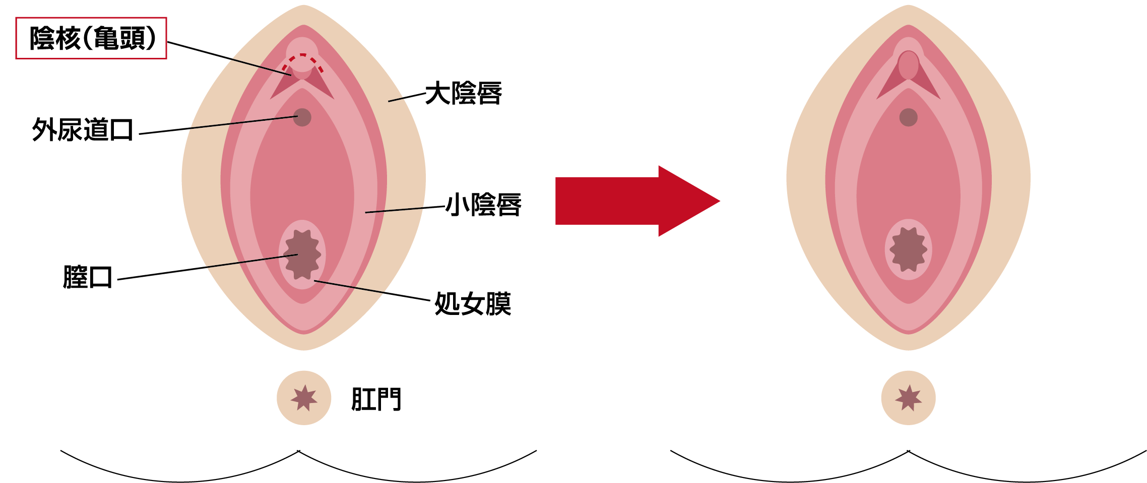 婦人科形成