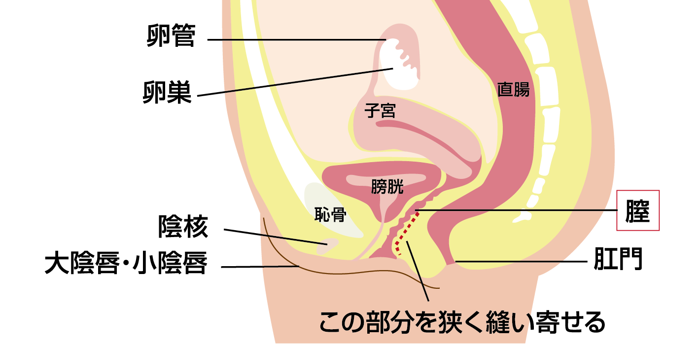 婦人科形成