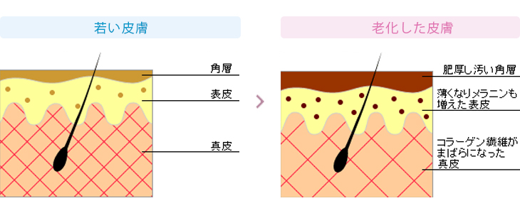 ラクトピールの特徴