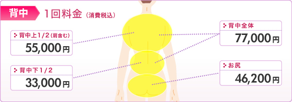 医療レーザー脱毛 施術部位