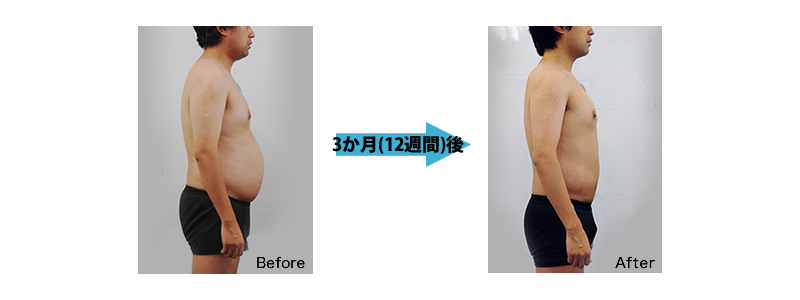 医療ダイエットコース 3か月(12週間)後