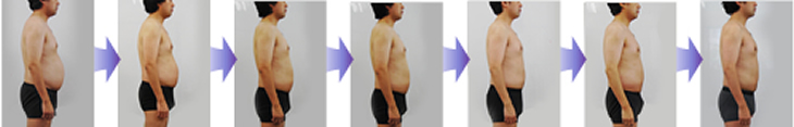 医療ダイエットコース 経過